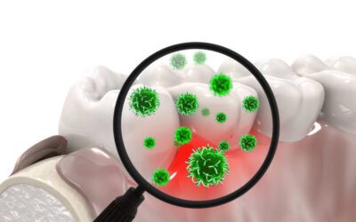 Especialista en Enfermedades e Infecciones Odontológicas