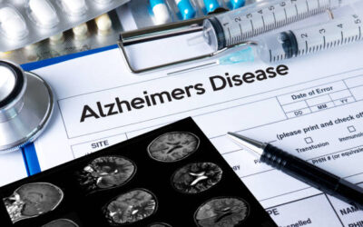 Especialista en Estimulación Cognitiva en la Enfermedad de Alzheimer