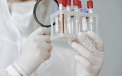 Especialista en Análisis de Muestras en el Laboratorio de Microbiología